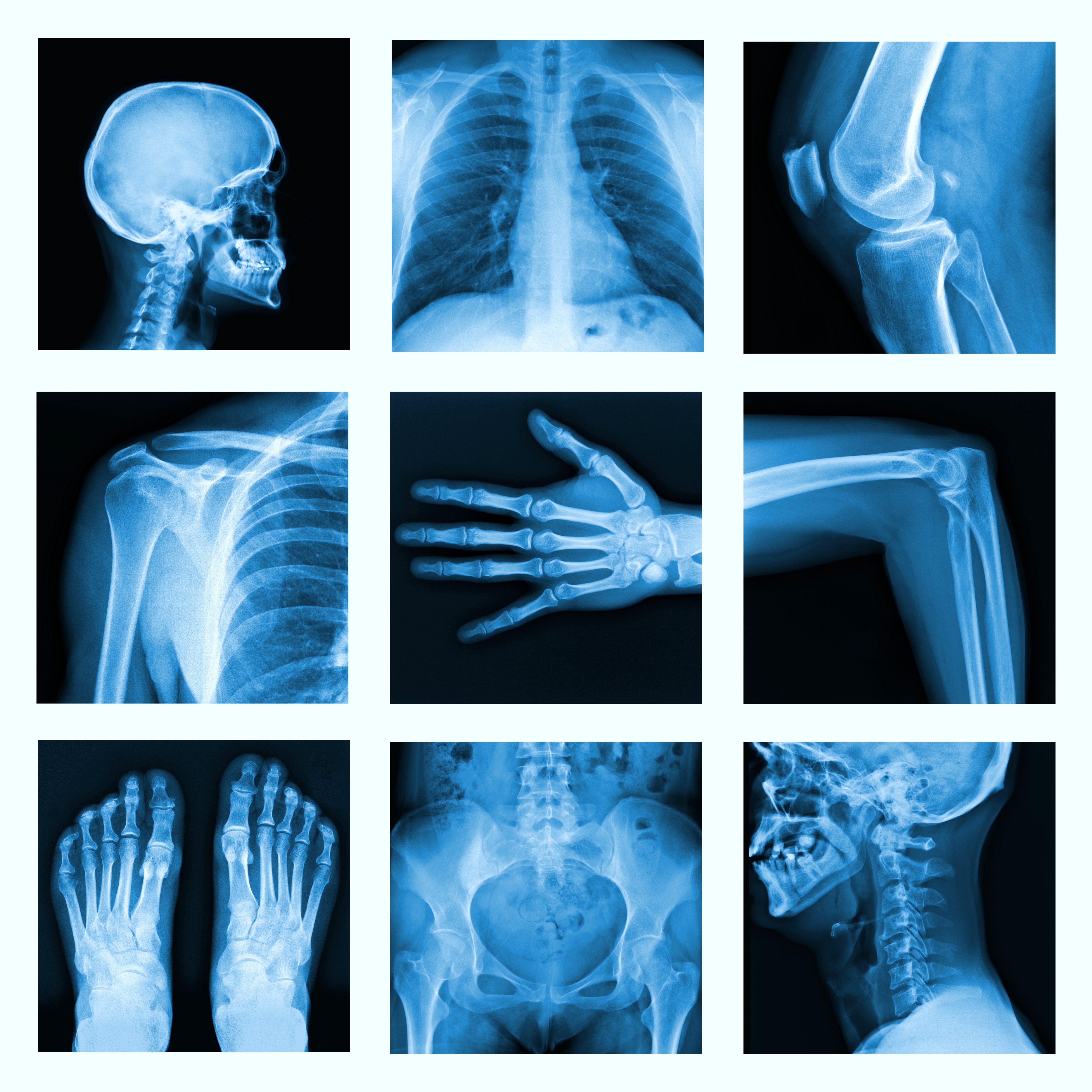 Collage of many X-rays in very good quality.