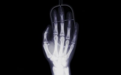 5 Myths of X-ray Radiation